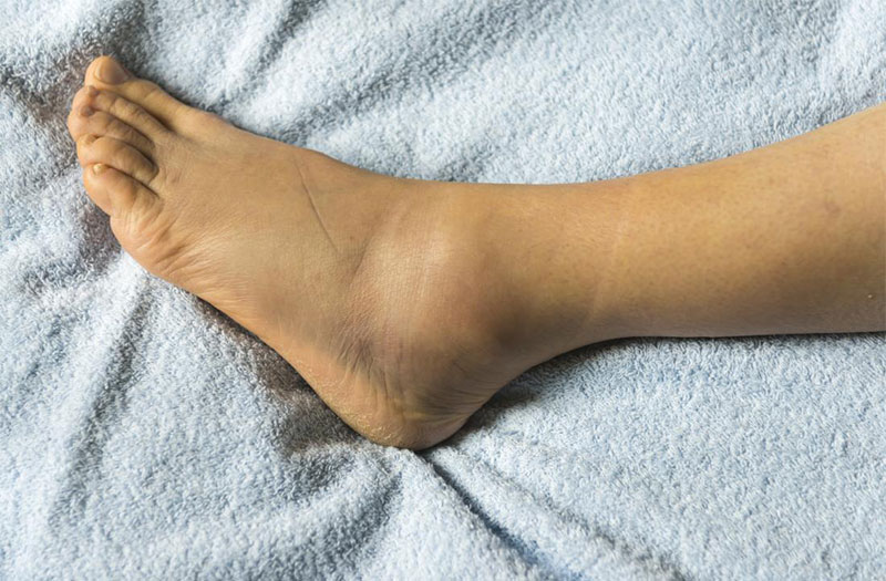 Có những triệu chứng nào đi kèm với máu xuống chân?
