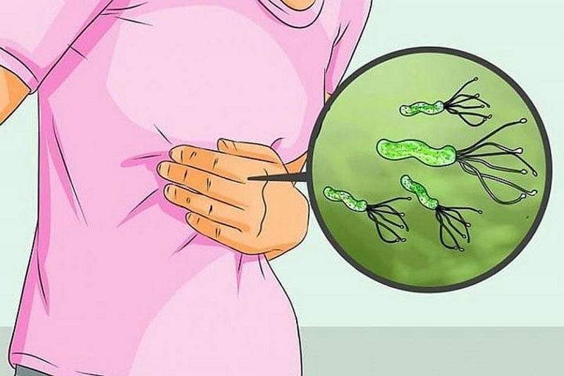 Vi khuẩn HP (Helicobacter Pylori) là gì và nó liên quan như thế nào đến bệnh ung thư dạ dày?
