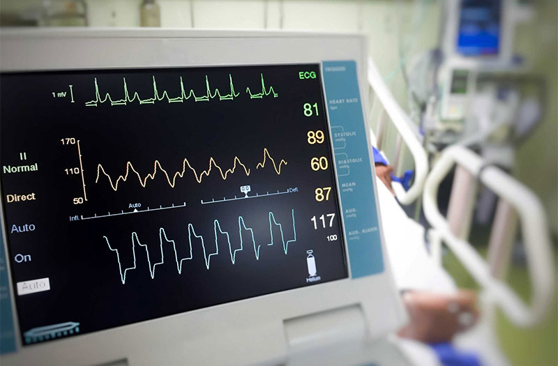  ECG có thể phát hiện được những biến chứng nguy hiểm liên quan đến thiếu máu cơ tim không?
