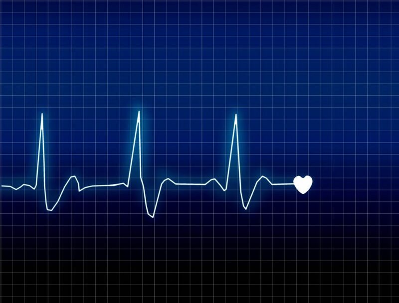 Cách thức thực hiện điện tâm đồ nhồi máu cơ tim và thông tin mà nó cung cấp về tim?
