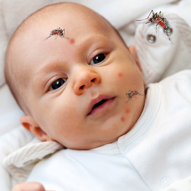 Làm thế nào để giảm ngứa khi trẻ bị côn trùng đốt sưng mắt?
