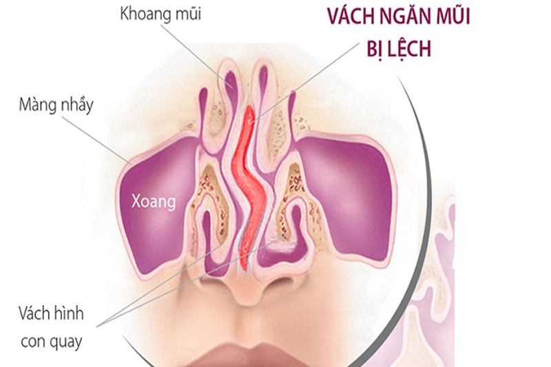 Khi nào cần đến bác sĩ khi gặp tình trạng khóe mắt bị sưng?