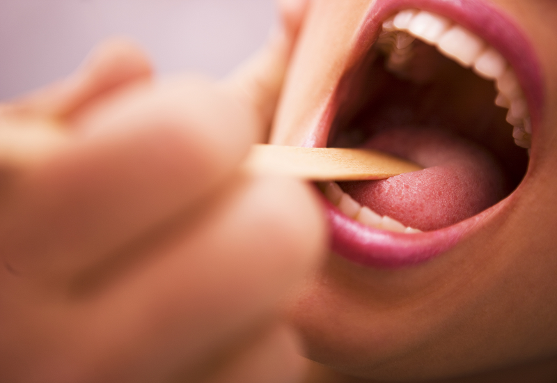 Dấu hiệu đầu tiên và phổ biến nhất của ung thư vòm họng giai đoạn đầu là gì?

