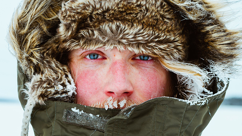 Cách điều trị và ngăn ngừa dị ứng thời tiết lạnh nổi mẩn đỏ là gì?