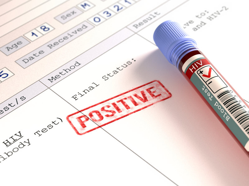 What is the purpose of the HIV Combo Ag/Ab test, also known as the HIV Combo test?
