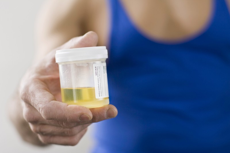What are the 10 parameters included in a urine test?