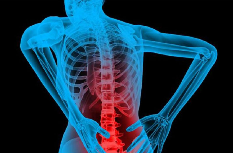Tìm hiểu về bệnh lao xương là bệnh gì và cách phòng ngừa