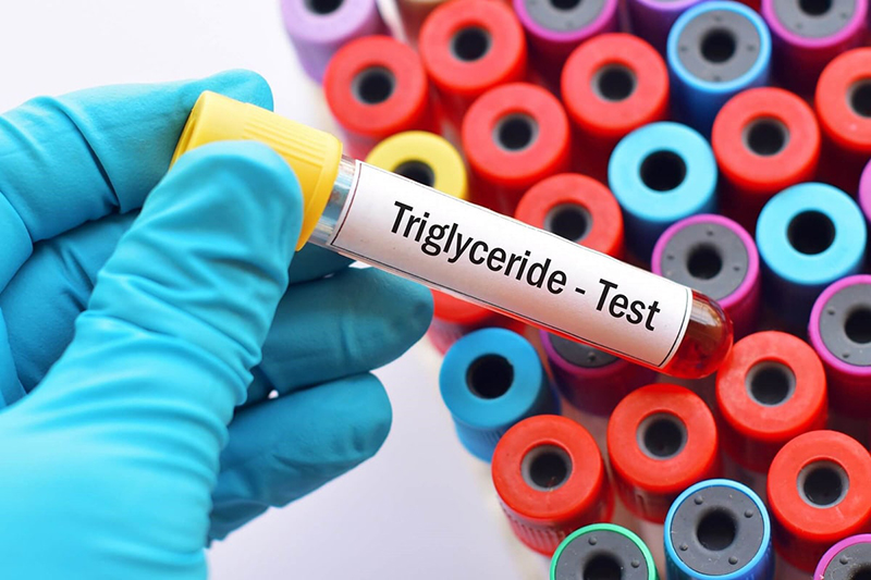 Chỉ số mỡ máu triglyceride là gì?
