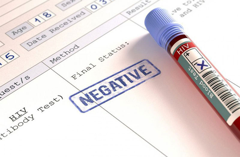 How to interpret the results of an HIV test using the giấy xét nghiệm hiv?