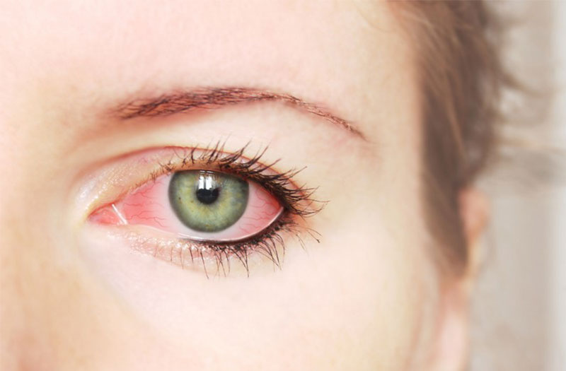 Tại sao việc ánh sáng mạnh và tia tử ngoại có thể gây hại cho mắt và cách phòng tránh?
