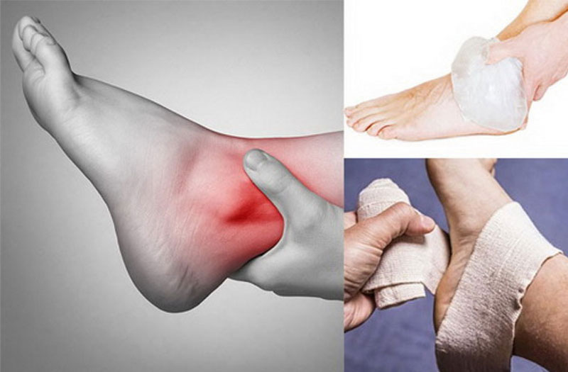 Trật khớp cổ chân là gì và tại sao nó gây đau nhức?
