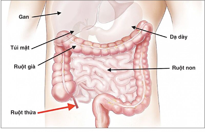 Khi nào bác sĩ nghi ngờ bệnh lý vùng bụng và quyết định chụp cắt lớp ổ bụng?
