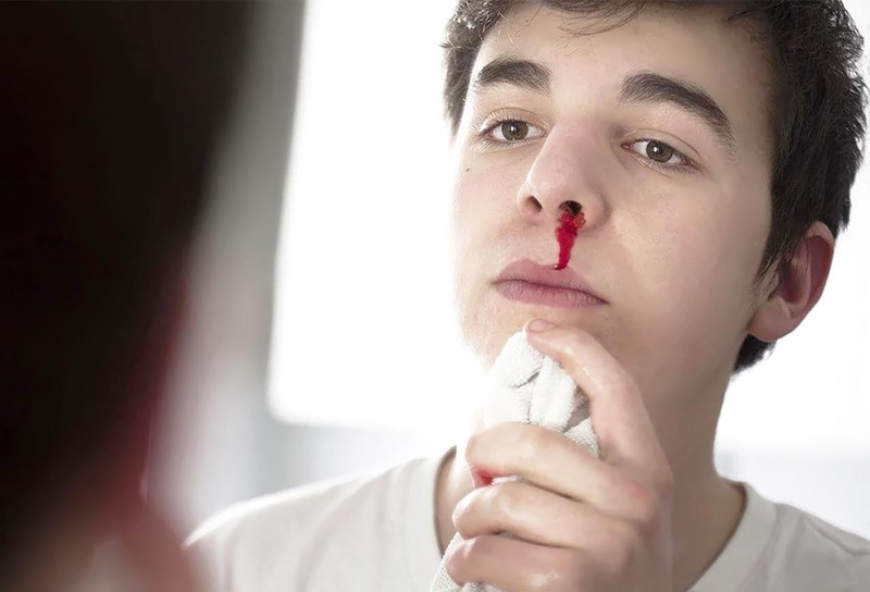 Chảy máu mũi - nguyên nhân do đâu và có nguy hiểm hay không?