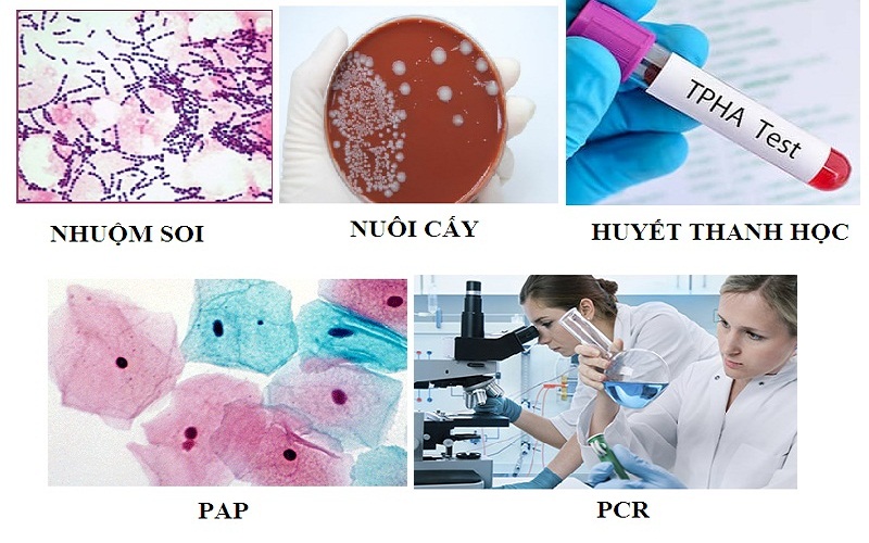 Công dụng của vi khuẩn lactobacillus trong việc duy trì hệ vi sinh đường ruột