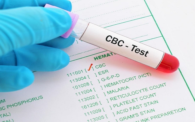 Nrbc trong xét nghiệm máu là gì?