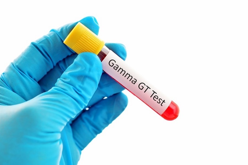 Chỉ số GGT trong xét nghiệm máu liên quan đến gì?