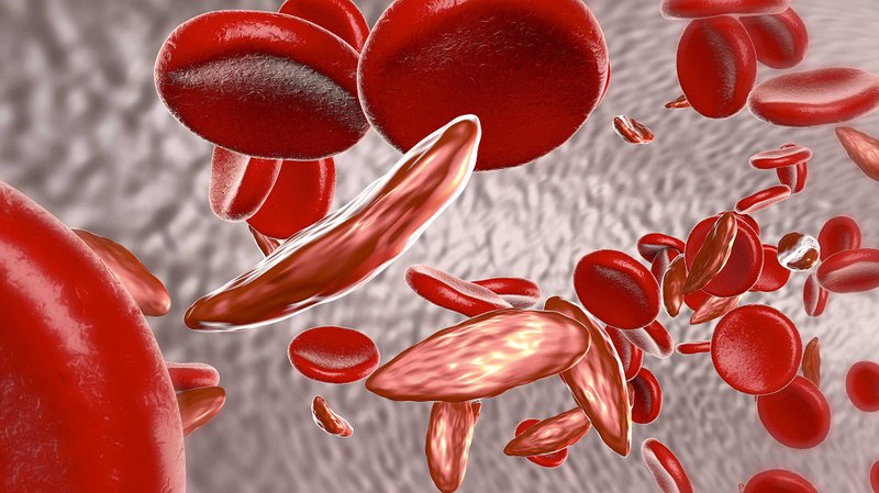 Thalassemia là gì?
