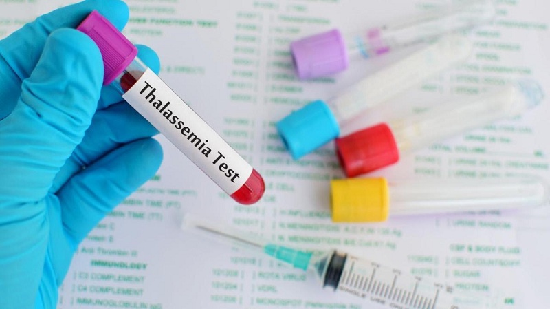 Xét nghiệm nào được sử dụng để chẩn đoán bệnh Thalassemia?
