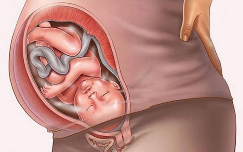 Cách giảm hình em bé trong bụng mẹ nhanh chóng và hiệu quả