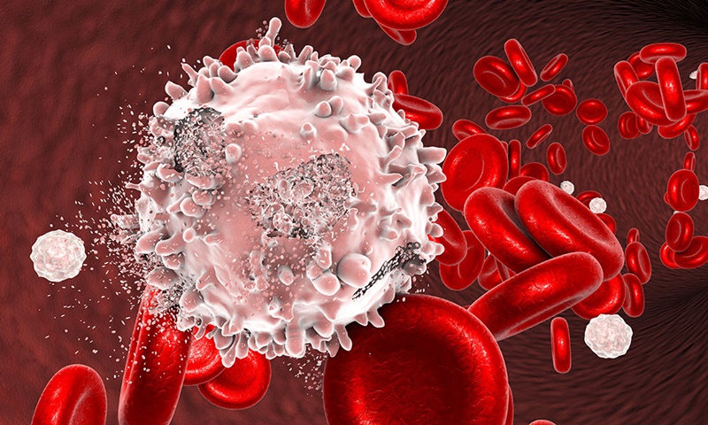 Các yếu tố nguy cơ nào có thể khiến người ta nên tầm soát ung thư máu?
