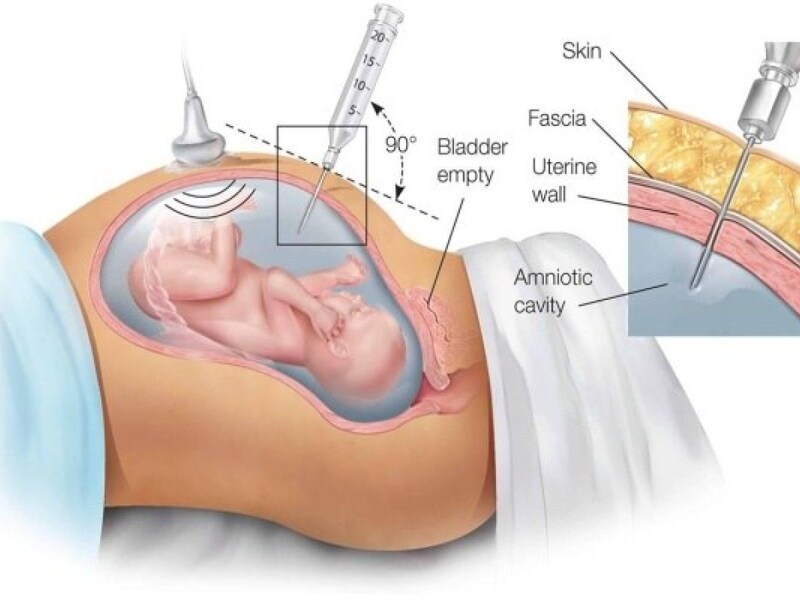 Độ chính xác của xét nghiệm ADN có ảnh hưởng đến kết quả xác định mối quan hệ huyết thống hay không?

