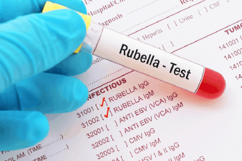 Loại xét nghiệm kháng thể sởi quai bị rubella có thể được thực hiện?
