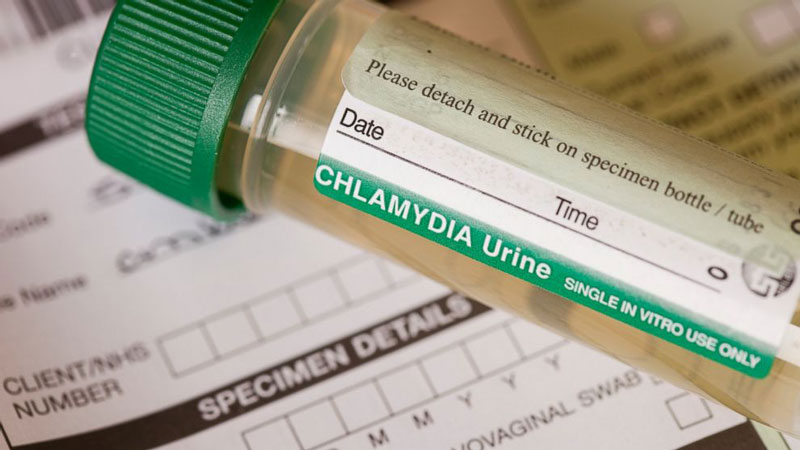 Xét nghiệm chlamydia giúp xác định nguyên nhân gây ra bệnh gì trong cơ thể?