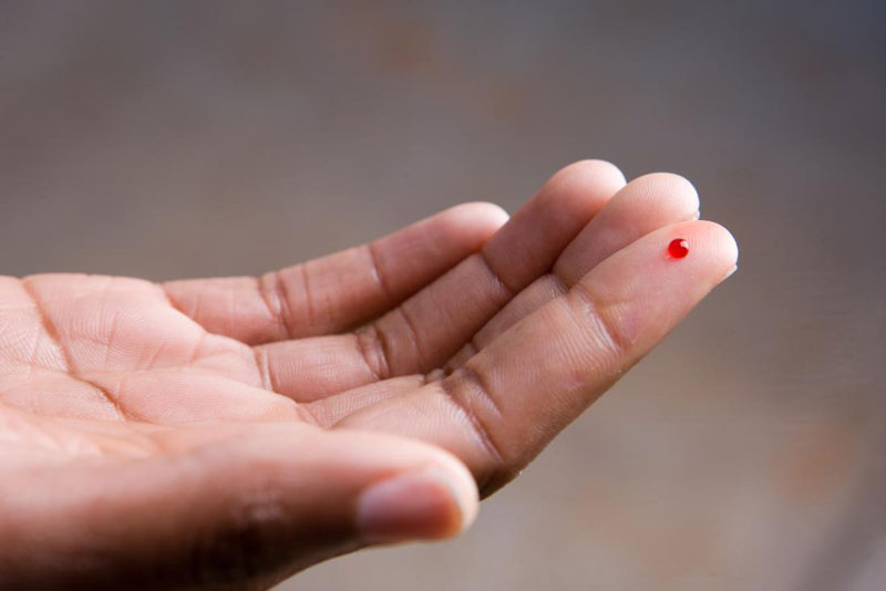 Khi nào nên xét nghiệm HIV để có kết quả chính xác nhất?