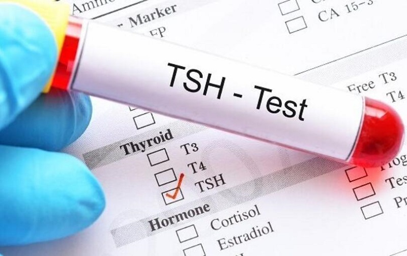 Kết quả xét nghiệm máu TSH liên quan đến các tình trạng rối loạn chức năng tuyến giáp như gì?