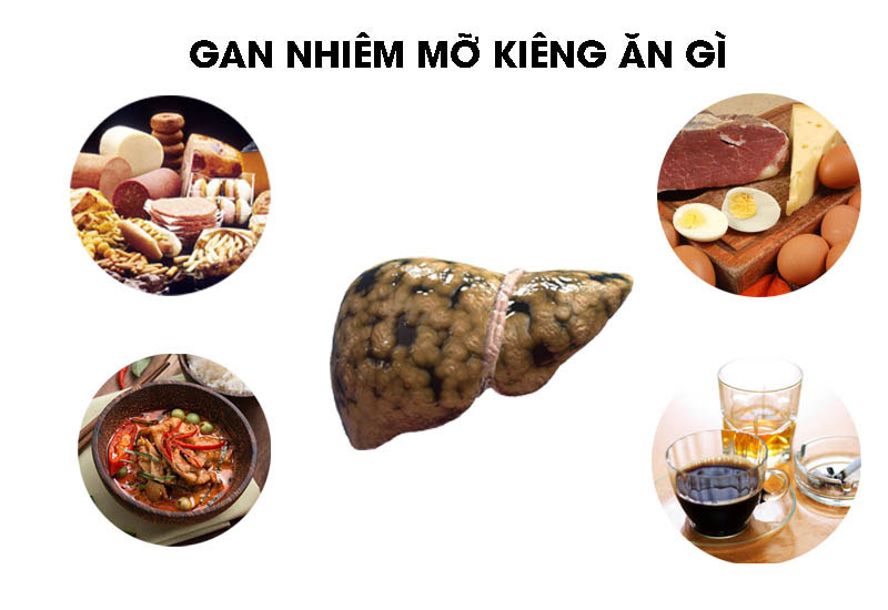 Những thói quen cần tránh khi bị gan nhiễm mỡ