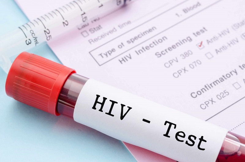 What does it mean if the result of an HIV test is indeterminate?