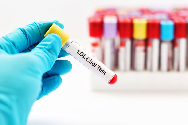 LDL trong xét nghiệm máu là gì?