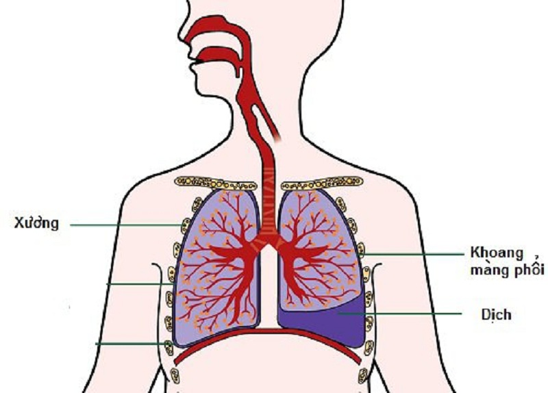 How is the fluid from the lungs tested in xét nghiệm dịch màng phổi?