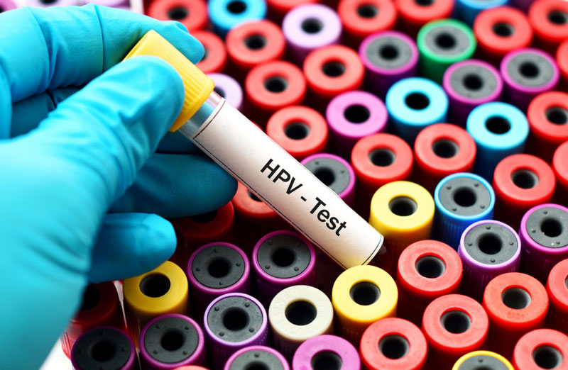 Kết quả xét nghiệm HPV âm tính có ý nghĩa gì?