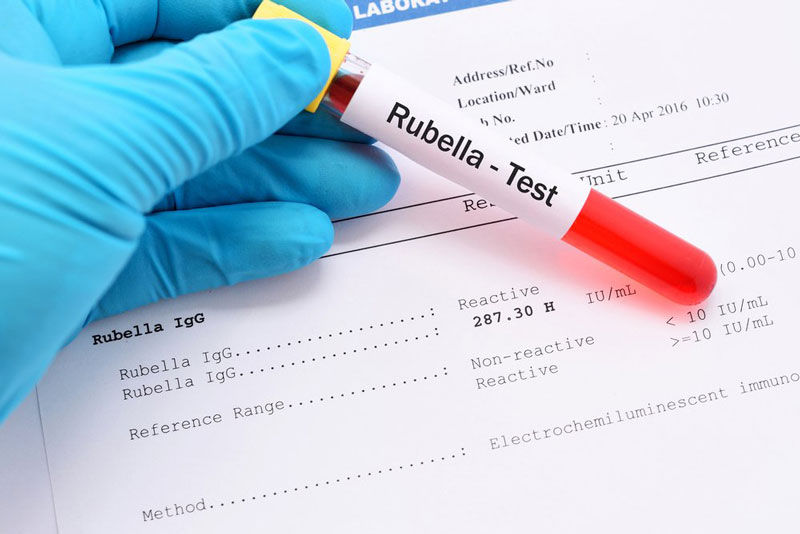 Kháng thể Rubella có tồn tại trong máu người bệnh hay không?
