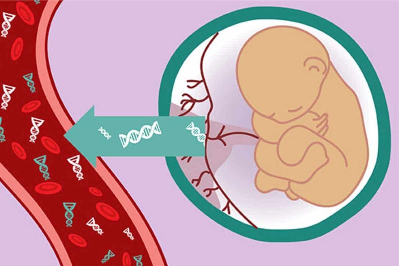  Đo độ mờ da gáy : Tìm hiểu về phương pháp đo và những điều cần biết