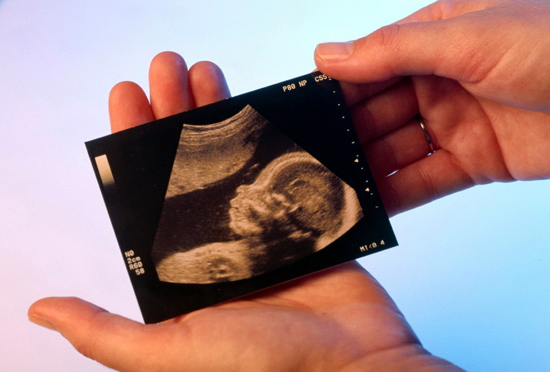 Tầm quan trọng của siêu âm thai tứ chi 3 đoạn trong quá trình theo dõi thai nhi