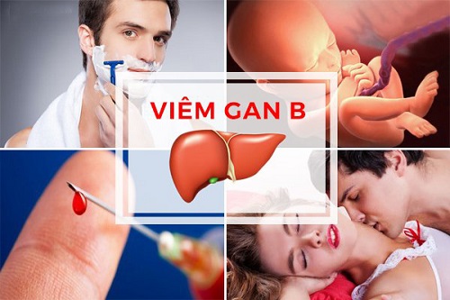 Viêm gan B có thể lây từ mẹ sang con không?
