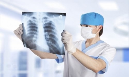 Các căn bệnh thông qua chụp X-quang phổi có thể được xác định?
