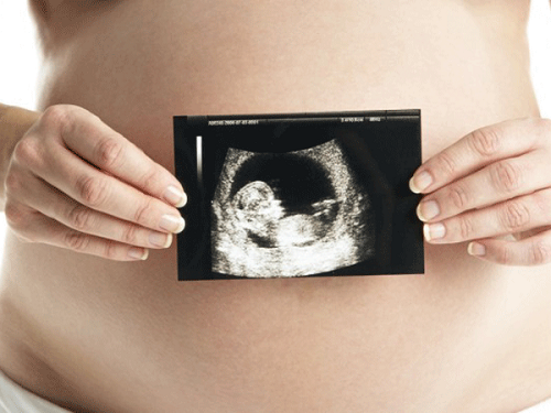 Nang bạch huyết ở thai nhi có khả năng gây tử vong ở tuổi thai sớm?