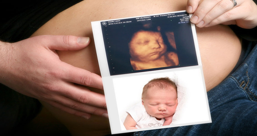 Tìm hiểu siêu âm thai 3 tháng đầu và những thông tin cần biết