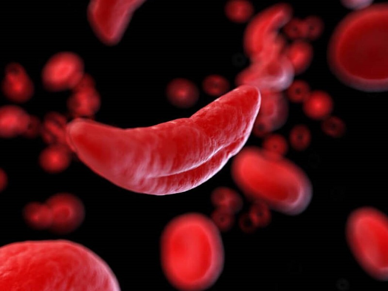  Xét nghiệm nước tiểu hồng cầu cao : Hướng dẫn và thời gian chờ đợi