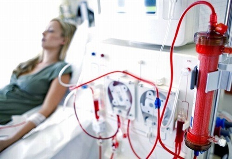 Lọc máu là phương pháp điều trị như thế nào cho bệnh nhân suy thận?
