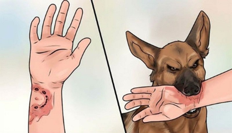 Sau khi bị chó dại cắn bao lâu thì tiêm phòng vaccine dại?