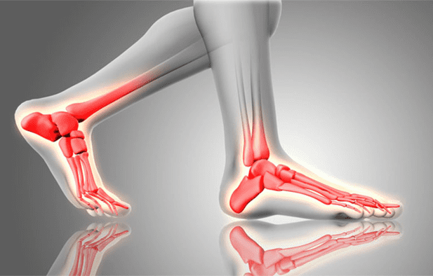 Các kiến thức căn bản về chụp cộng hưởng từ chân để phát hiện các vấn đề sức khỏe