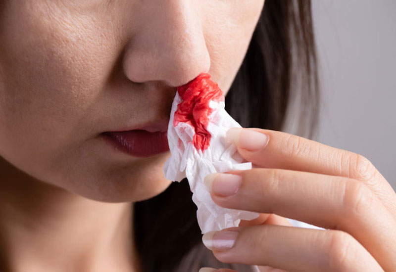 Xì mũi ra đờm có máu là triệu chứng của bệnh gì?