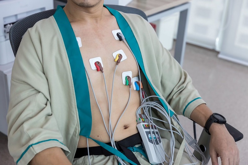 Đo Holter điện tim giúp đánh giá mức độ, phân loại rối loạn nhịp tim