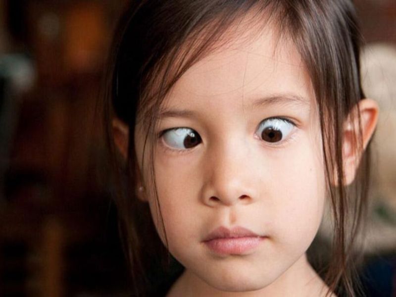  Mắt lé có di truyền không ? Cách giảm ngứa mắt hiệu quả và tự nhiên