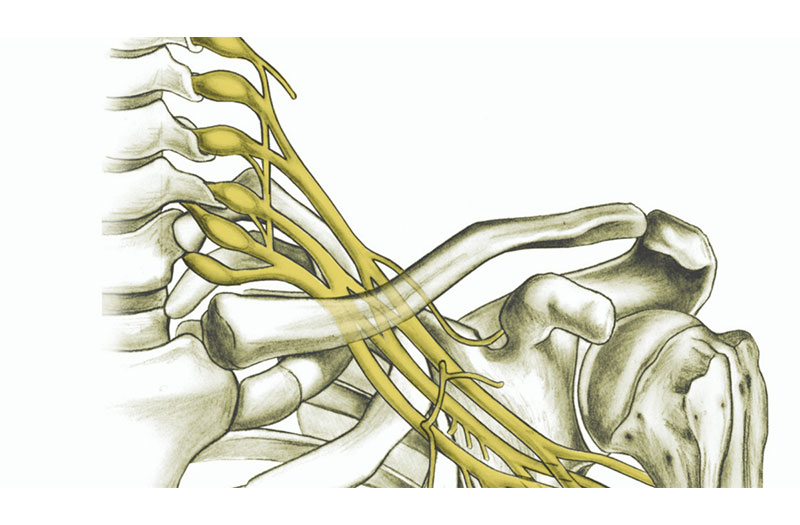 Cách nhận biết và điều trị chi phối đám rối thần kinh cánh tay và tác dụng của chúng trong cơ thể