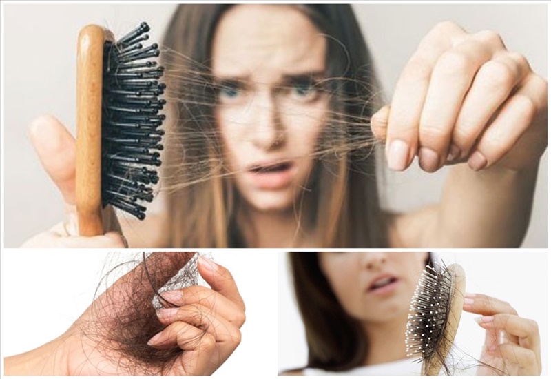 Rụng tóc nhiều là bị bệnh gì? Biện pháp dứt điểm tình trạng tóc rụng –  Cardina